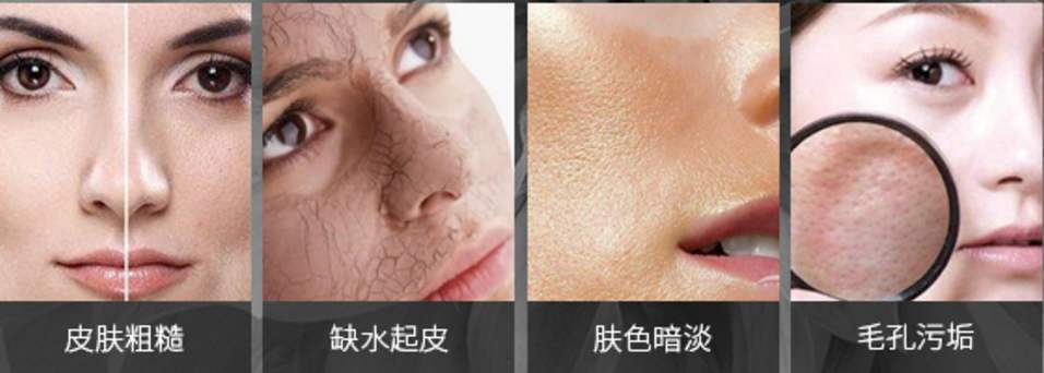 皮膚粗糙怎么辦？按摩這個(gè)穴位能改善