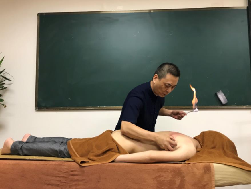 中醫(yī)可以通過拔罐辨別體質