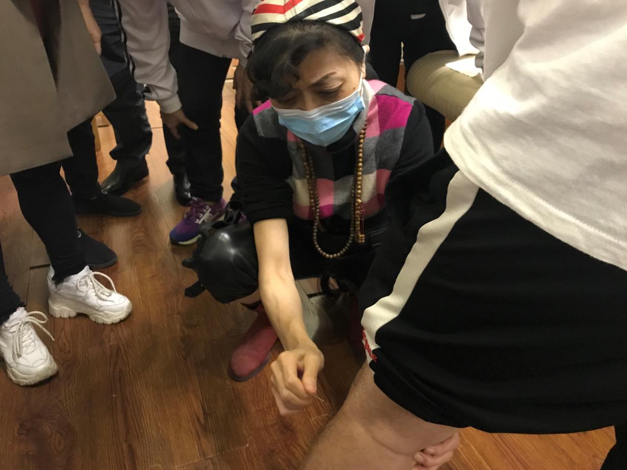 針灸怎么治療小腿酸痛浮腫？