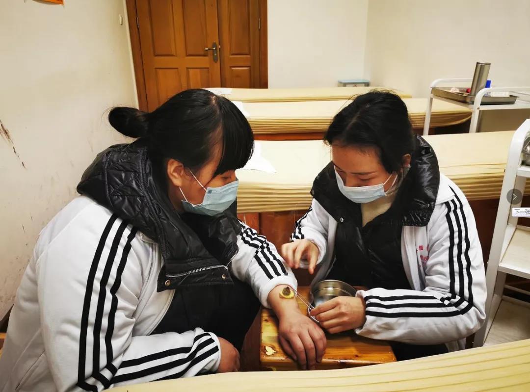重慶康復(fù)理療培訓(xùn)：怎樣選擇適合的艾灸工具？